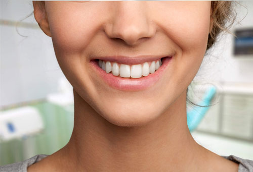 Teeth Whitening Toronto